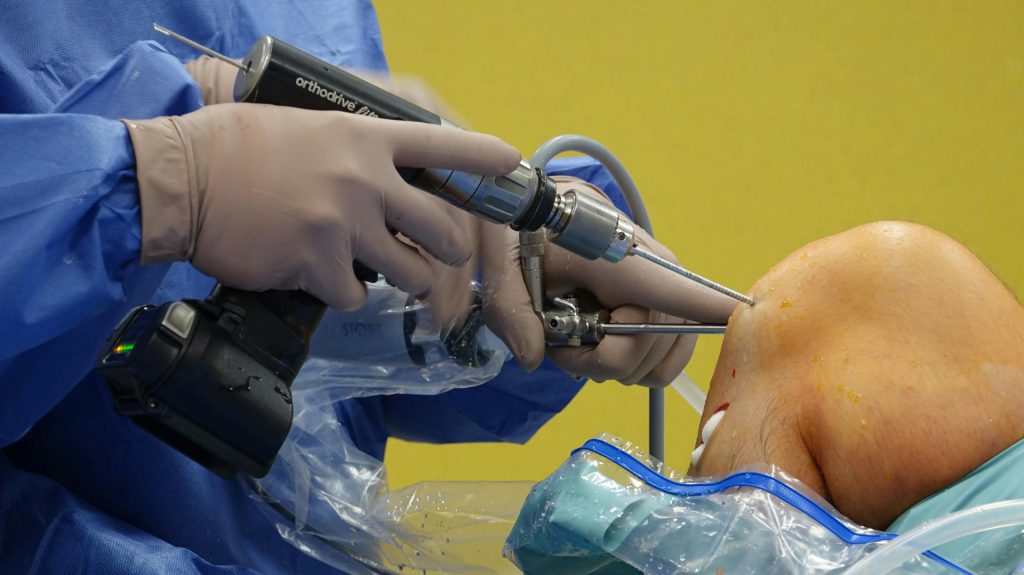acl injury recovery