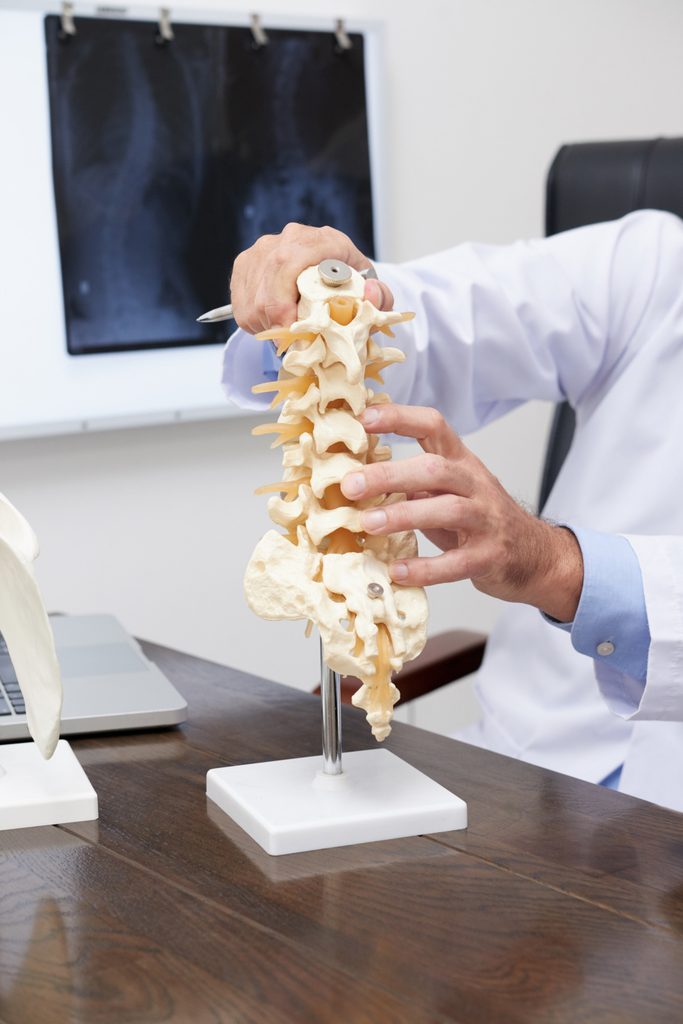 Doctor holding a lumbar spine model showing the L4-L5 disc level and surrounding nerve roots